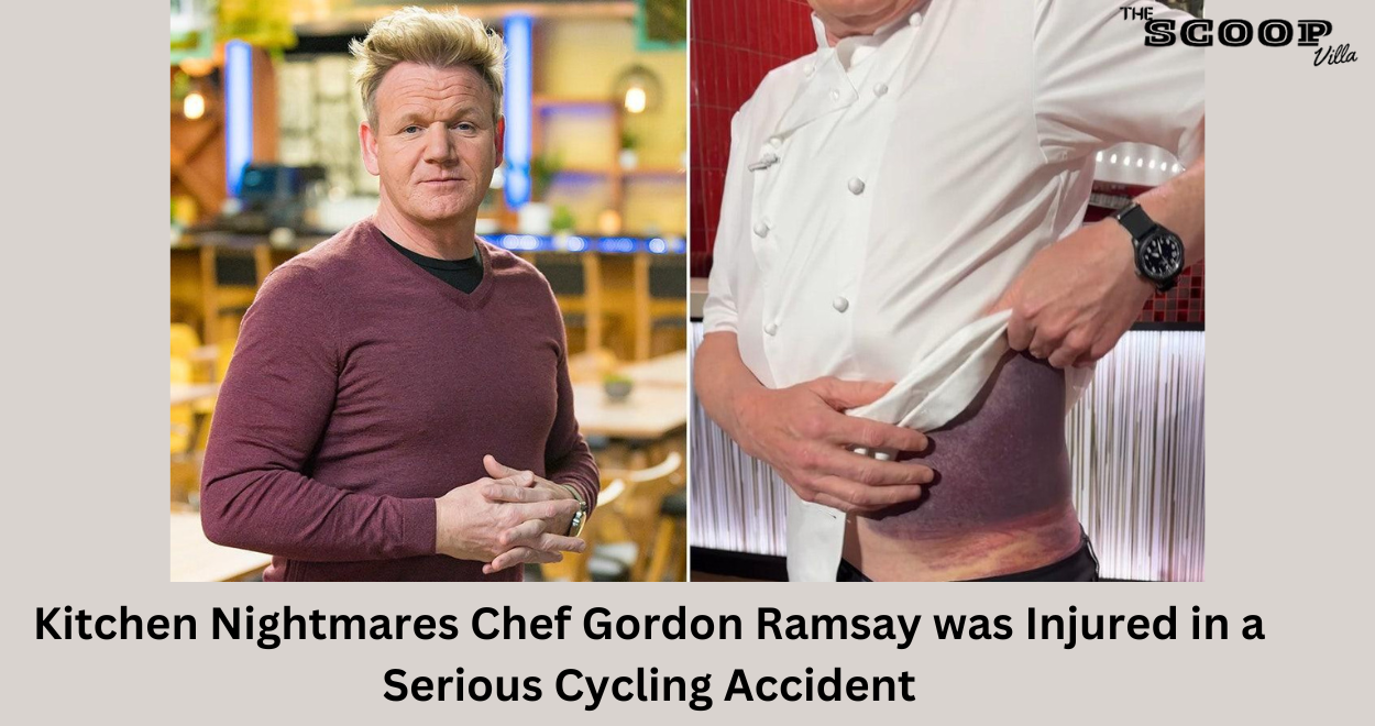 Kitchen Nightmares Chef Gordon Ramsay was Injured in a Serious Cycling Accident